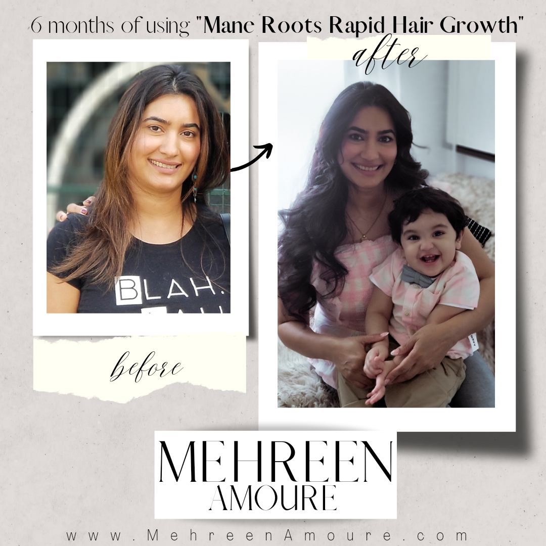 Mehreen Amoure Rapid hair growth oil for hair and scalp health and growth. Great to use for people with hair loss, hair fall, bald spots, postpartum hair loss, severely damaged & dull hair, alopecia, heat damage, dandruff, frizzy, dull, dry, oily greasy h